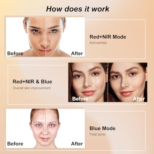 Avorla Beauty LED Mask - Image 5
