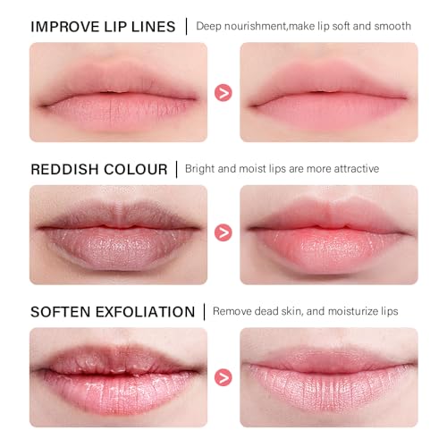 Loske Sleeping Lip Mask - Image 5