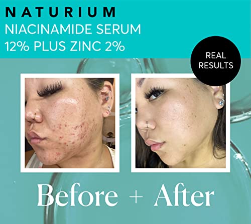 Naturium Niacinamide Face Serum 12% + Zinc 2% - Image 5